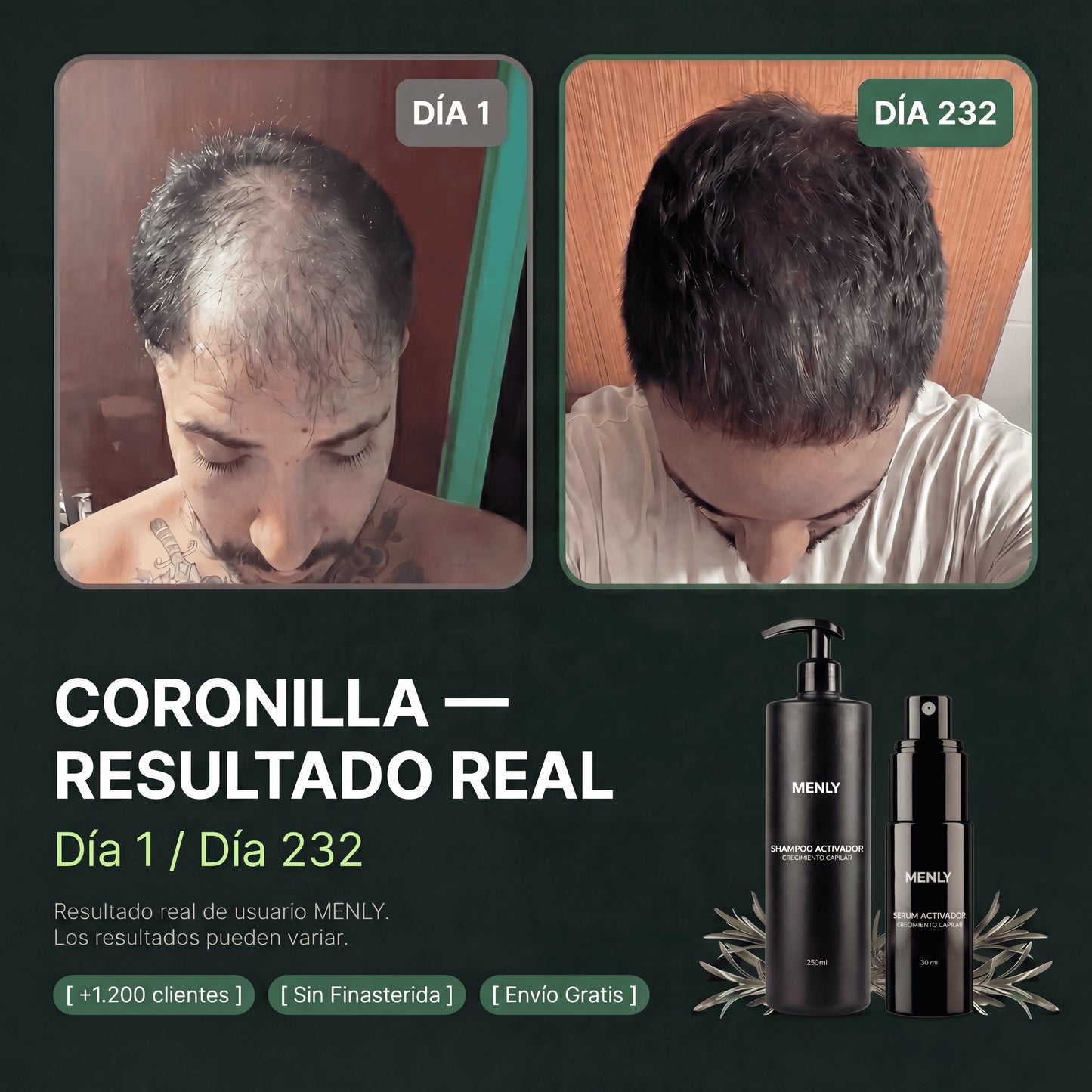 Protocolo contra la alopecia | Recuperá tu pelo sin efectos secundarios.