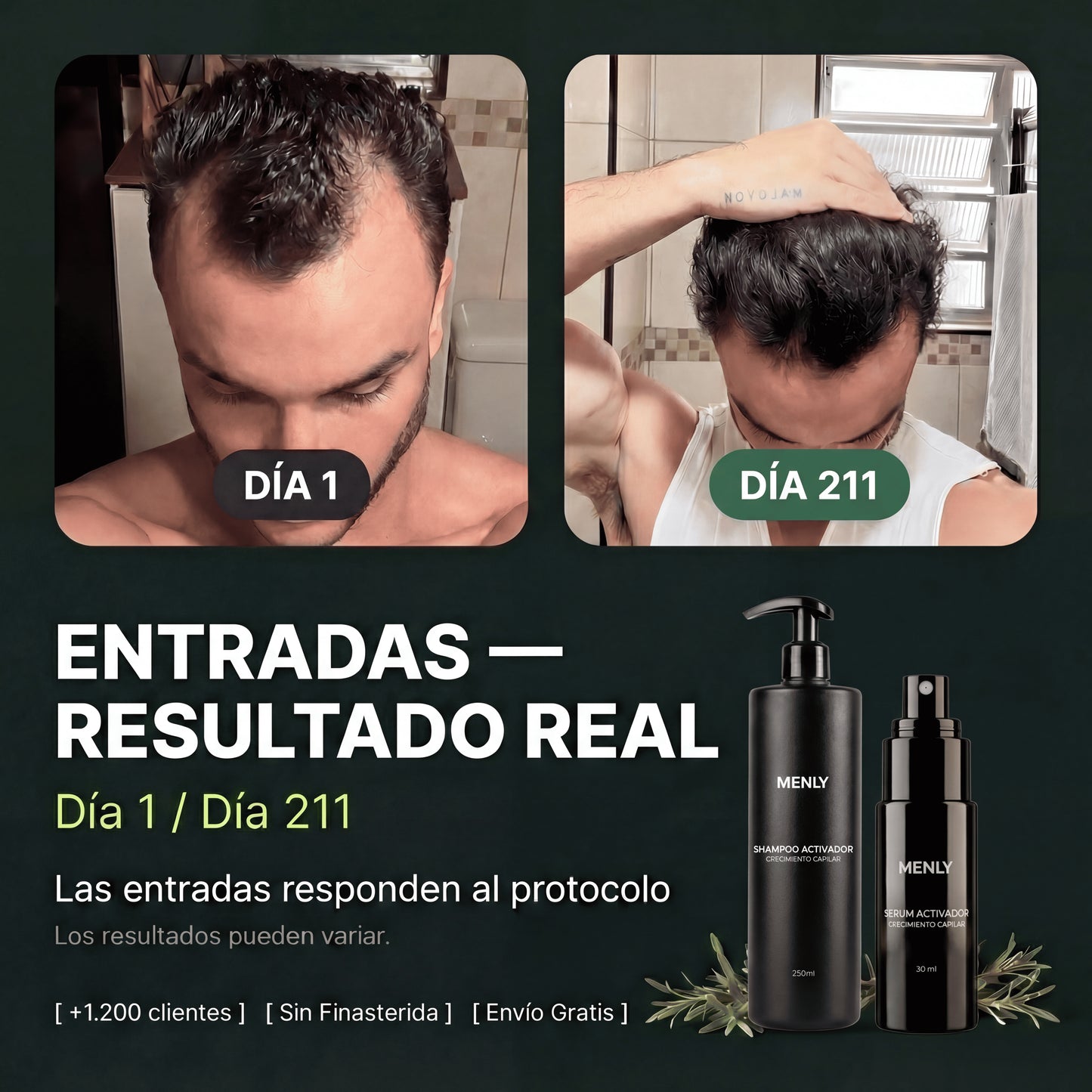 Protocolo contra la alopecia | Recuperá tu pelo sin efectos secundarios.