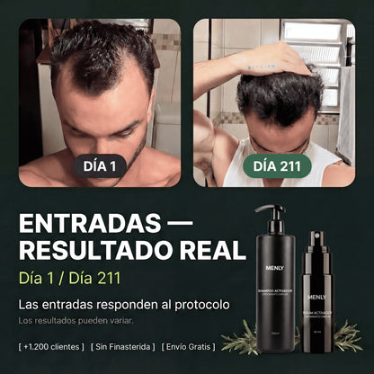 Protocolo contra la alopecia | Recuperá tu pelo sin efectos secundarios.
