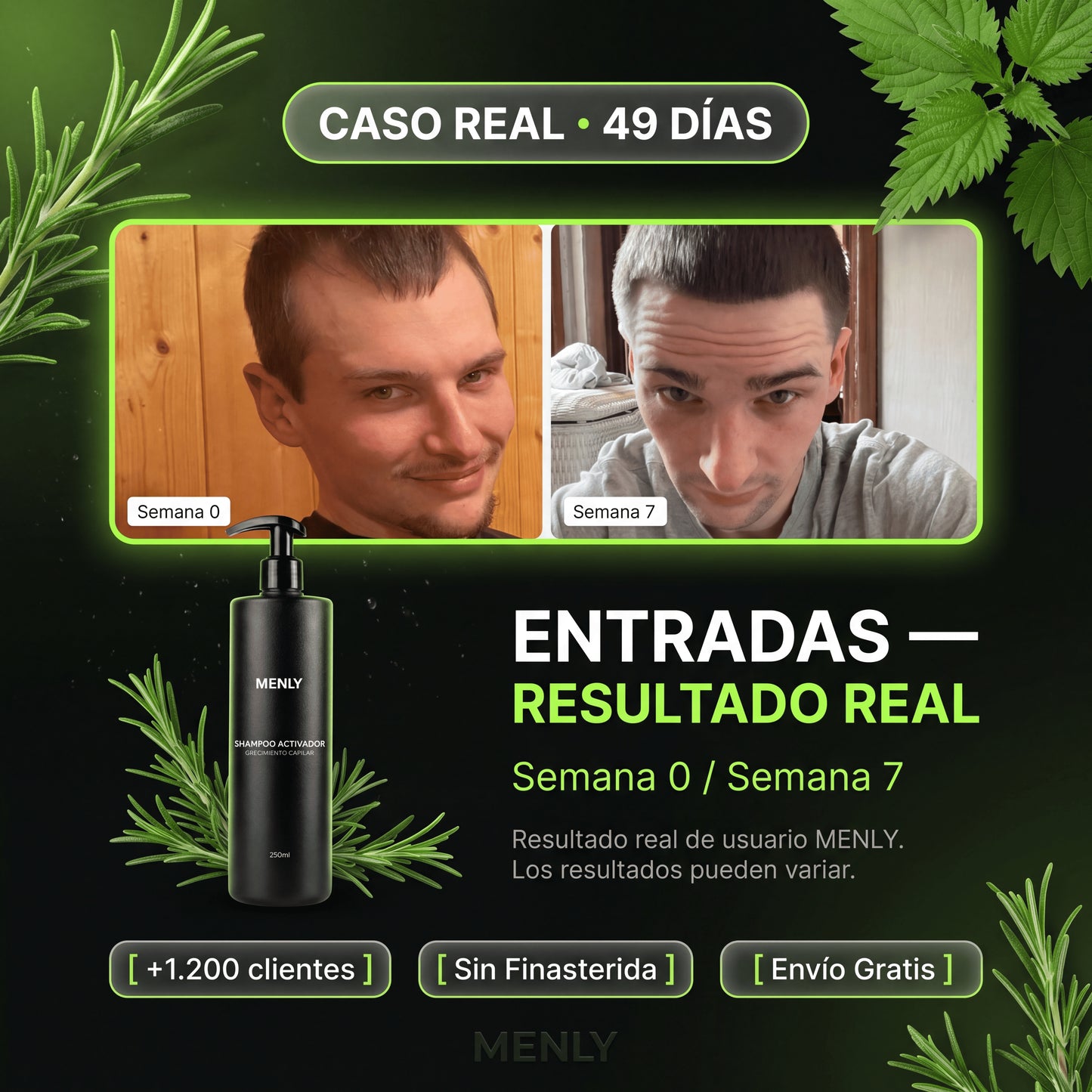 Shampoo | Frená la caída y estimulá la raíz en cada baño.