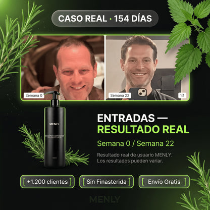 Shampoo | Frená la caída y estimulá la raíz en cada baño.
