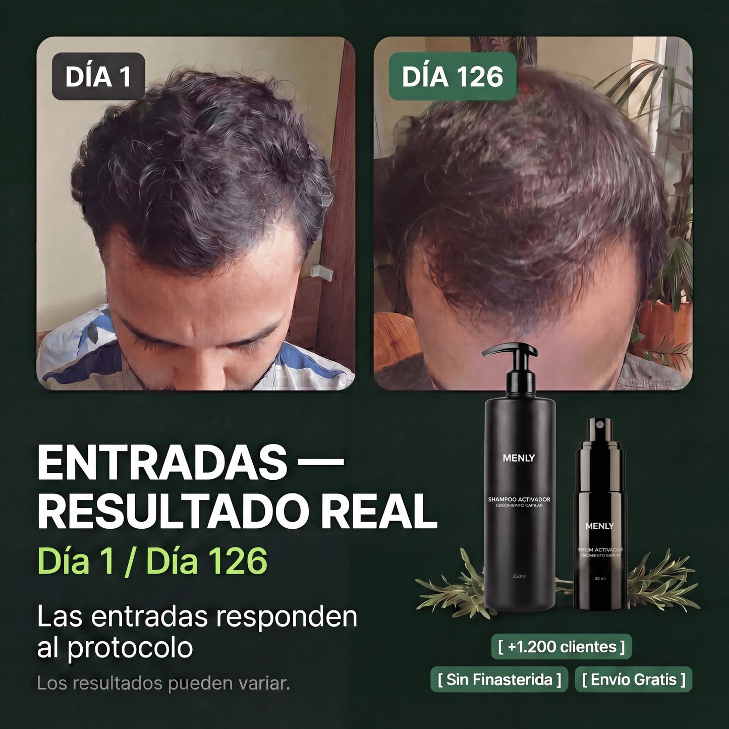 Protocolo contra la alopecia | Recuperá tu pelo sin efectos secundarios.