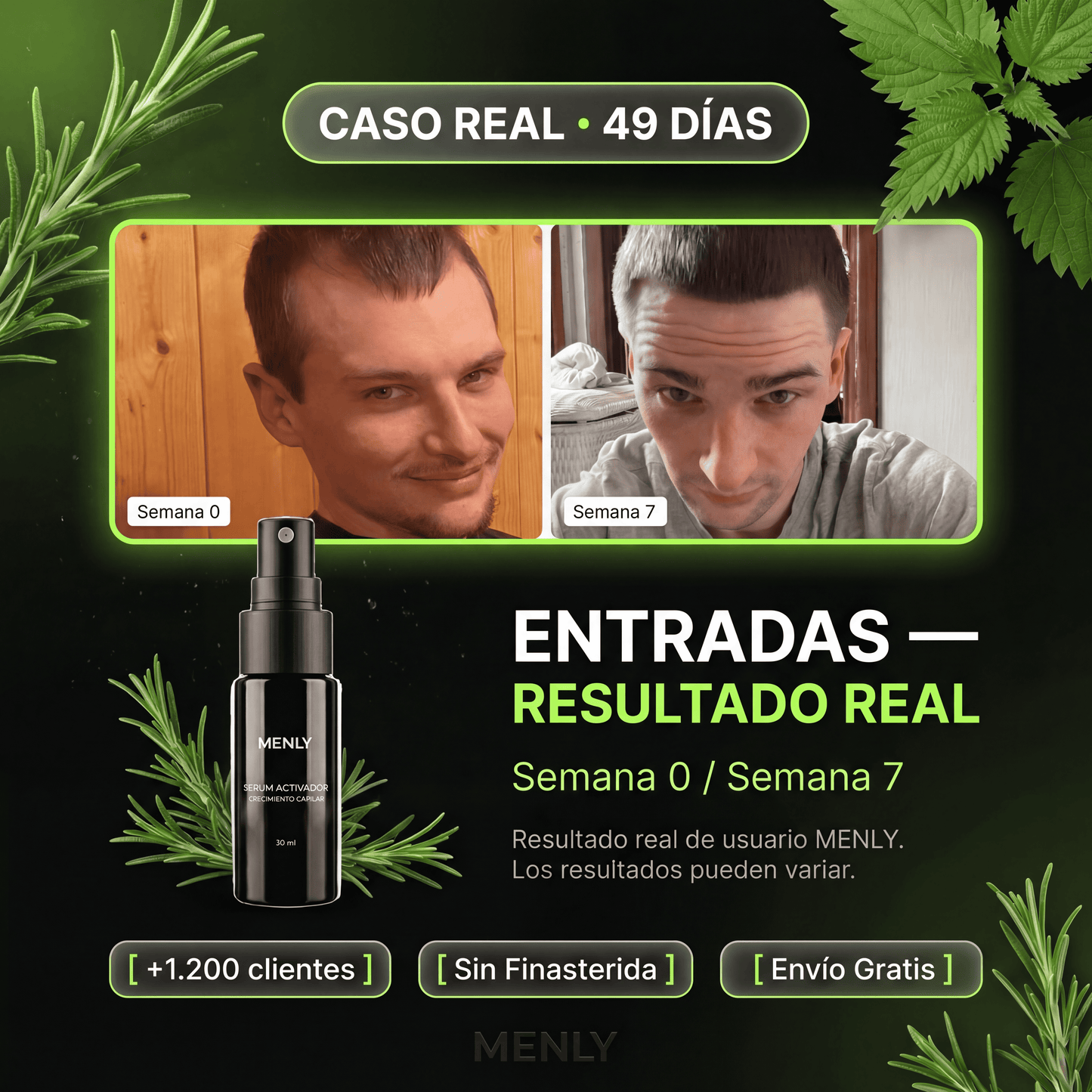 Loción Capilar Menly | Estimula el crecimiento capilar de raíz