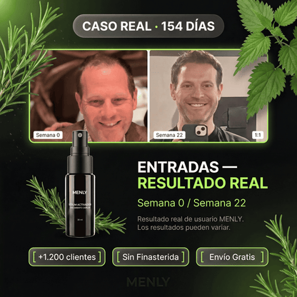 Loción Capilar Menly | Estimula el crecimiento capilar de raíz